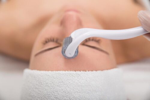 Ejollify.com - 16 Different Types of Facials - Microneedling